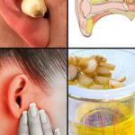 Grounding with Trees: How Barefoot Earthing and Tree Energy Can Restore Balance