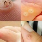 Goldenberries (Physalis peruviana): A Nutrient-Packed Powerhouse for Health and Vision