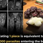 Ginger Water: The Ultimate Fat-Burning Drink for a Slimmer Waist, Arms, Back & Thighs!